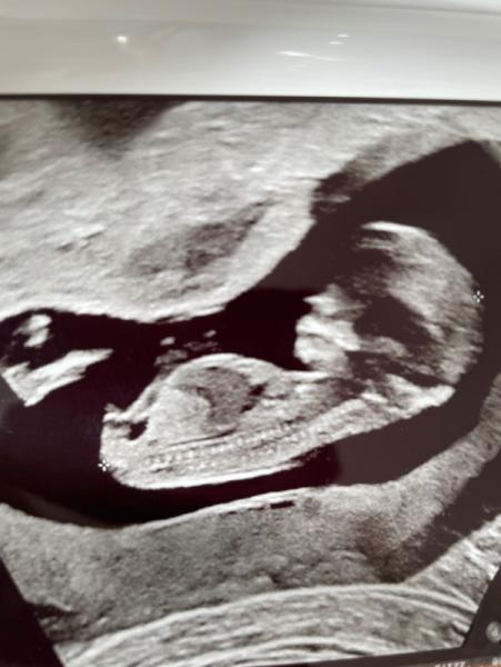 Bild zu Ratet mal - Nub Theorie - Forum für April - Mamis