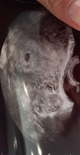 Bild zu Erster Termin - Forum für April - Mamis