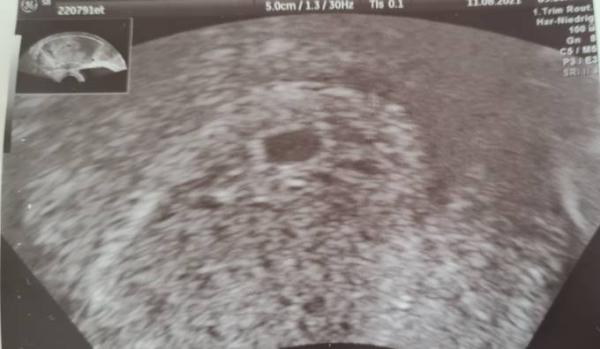 Bild zu Unsicher und ängstlich :( - Forum für April - Mamis