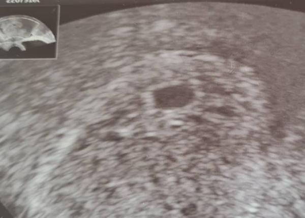 Bild zu Könnte man da den Dottersack deuten? - Forum für April - Mamis