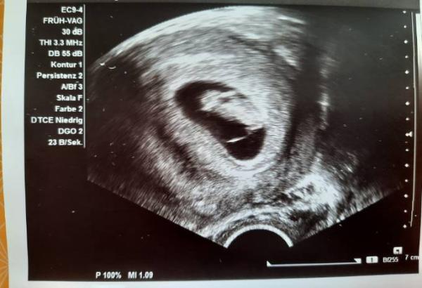 Bild zu ...Endlich beim Arzt und das Herz schlägt! :) - Forum für April - Mamis