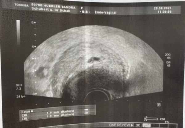 Bild zu Ultraschall - Forum für April - Mamis