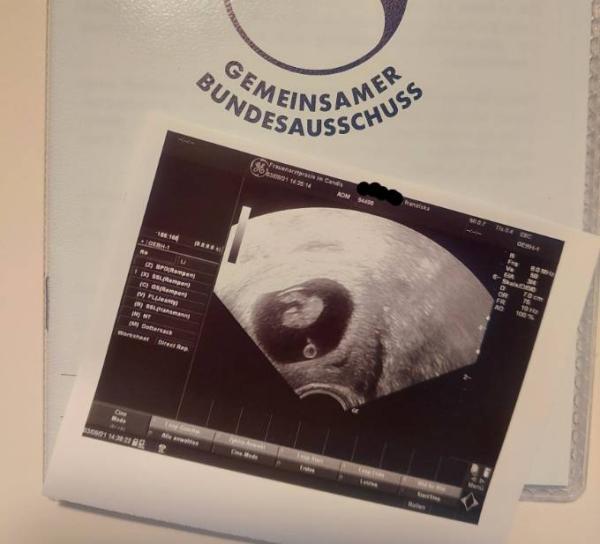 Bild zu Wieder da von zweiten Termin ❤️ - Forum für April - Mamis