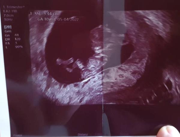 Bild zu Erster Ultraschall bei 10+1 - Forum für April - Mamis