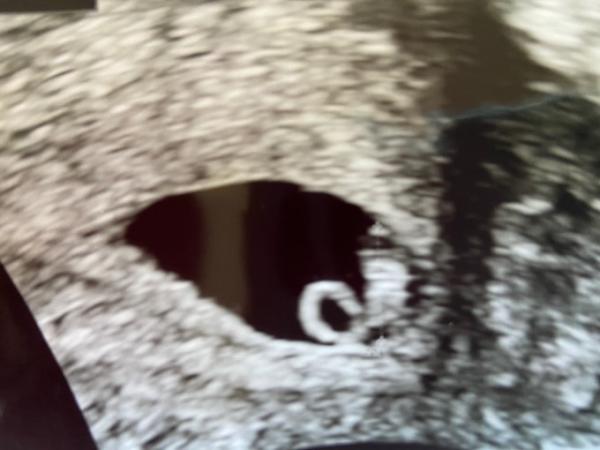 Bild zu 2. Ultraschall bei 7 + 1 - Forum für April - Mamis