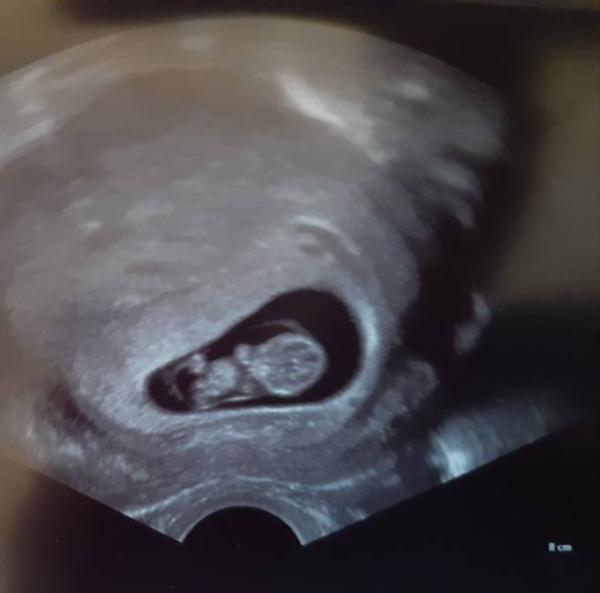 Bild zu Erleichtert... - Forum für April - Mamis