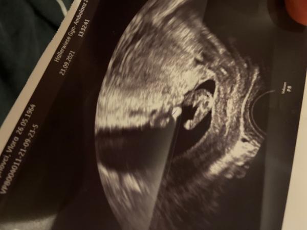 Bild zu Hallo Ihr Lieben - Forum für April - Mamis