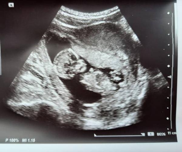 Bild zu So glücklich!!! - Forum für April - Mamis
