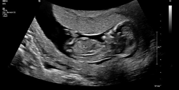 Bild zu Mädchen oder Junge was denkt ihr? - Forum für April - Mamis