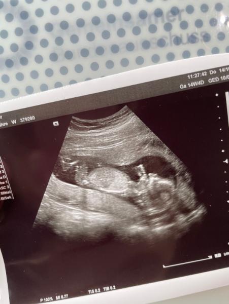 Bild zu Mädchen oder Junge? - Forum für April - Mamis