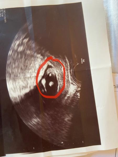 Bild zu Was meint ihr ? - Forum für April - Mamis