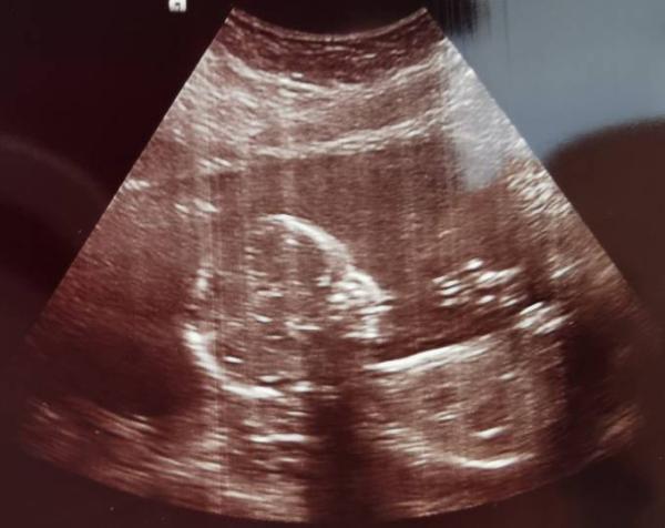 Bild zu Was denkt ihr - Forum für April - Mamis