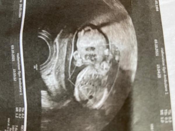 Bild zu Hallo Ihr Lieben - Forum für April - Mamis