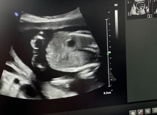 Bild zu Baby Geschlecht - Forum für April - Mamis