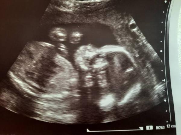 Bild zu Endlich auch ein sicheres Outing - Forum für April - Mamis