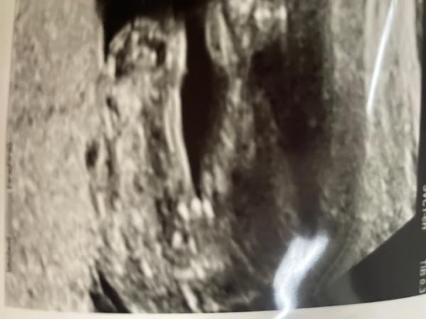 Bild zu Geschlecht? - Forum für April - Mamis