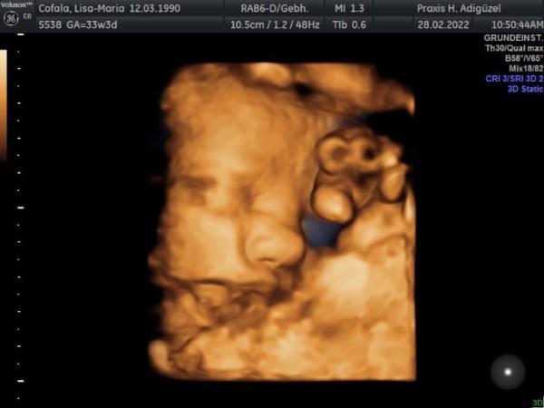 Bild zu Babyboy 💙 - Forum für April - Mamis