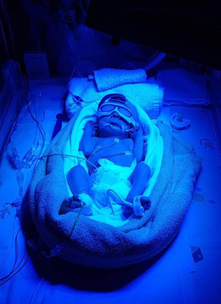 Bild zu Phototherapie - Forum für April - Mamis