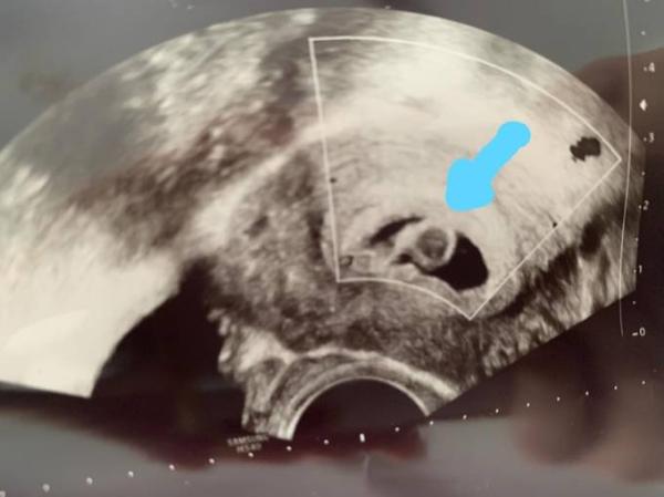 Bild zu Komischer Kreis in Fruchthöhle - Forum für April - Mamis