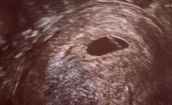 Bild zu Ich kann auch mal mit einsteigen - Forum für April - Mamis
