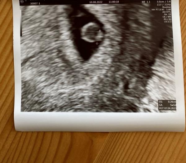 Bild zu Keine Symptome - Forum für April - Mamis