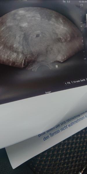 Bild zu Ultraschall 5+3SSW - Forum für April - Mamis