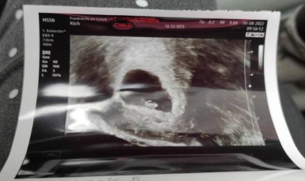 Bild zu Erster Termin - Forum für April - Mamis