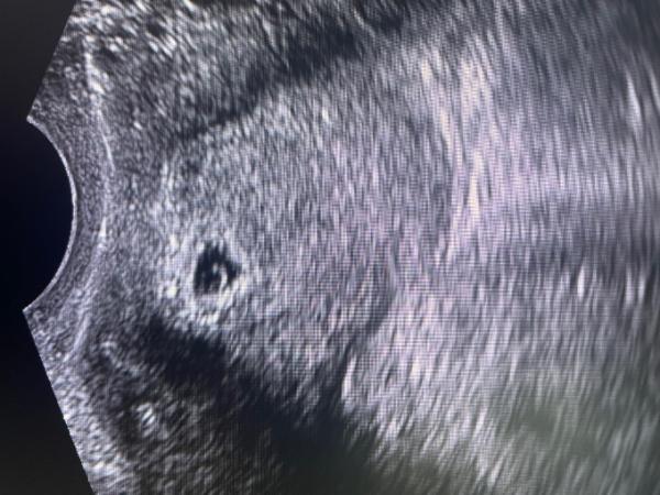 Bild zu Angst 🥺 - Forum für April - Mamis