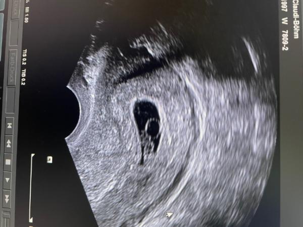Bild zu Heutiger Termin - Forum für April - Mamis