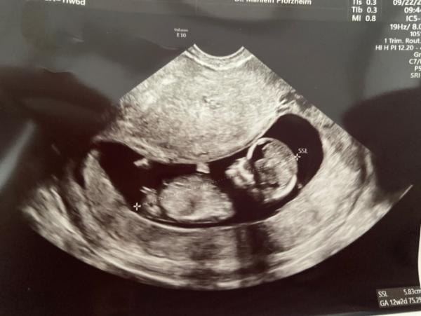 Bild zu Nub Theorie - Forum für April - Mamis