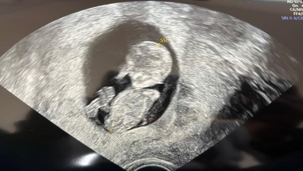 Bild zu Frauenarzt/Samstagstalk - Forum für April - Mamis