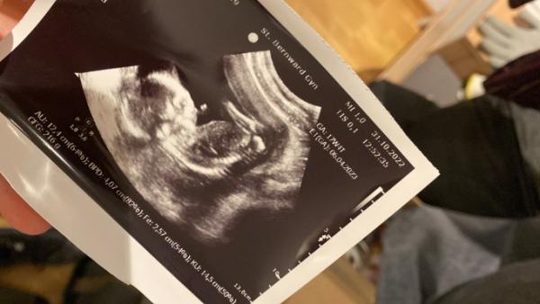 Bild zu Heutiger Termin - Forum für April - Mamis
