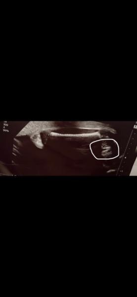 Bild zu Geschlecht erkennbar ? - Forum für April - Mamis