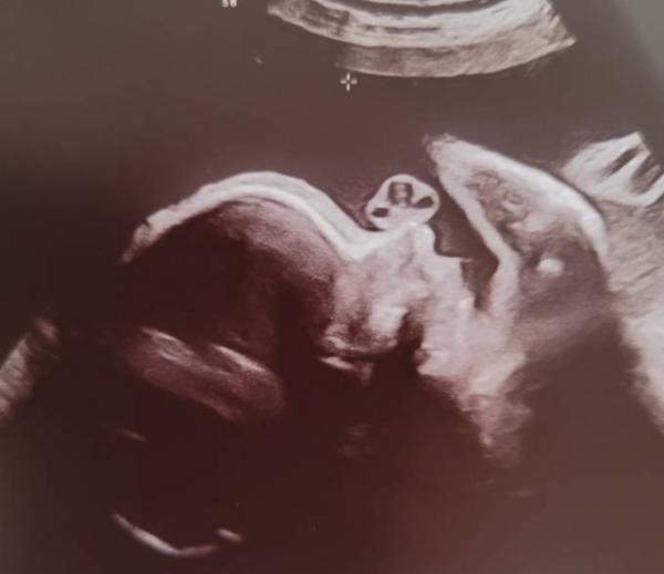 Bild zu 3. US, erstes CTG und Zuckertest - Forum für April - Mamis