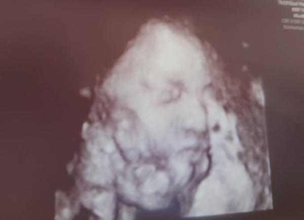 Bild zu Letzter Ultraschall - Forum für April - Mamis
