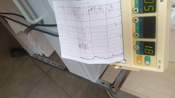 Bild zu Druck nach unten und häufig Stuhlgang 33+1 Ssw - Forum für April - Mamis