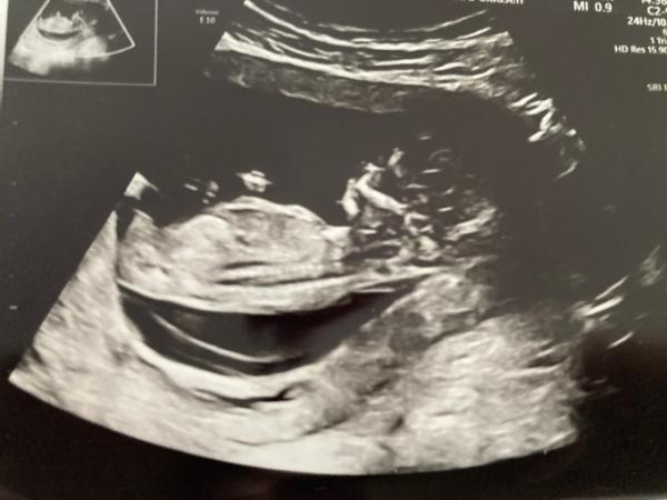 Bild zu Weihnachtsbaby - Forum für April - Mamis