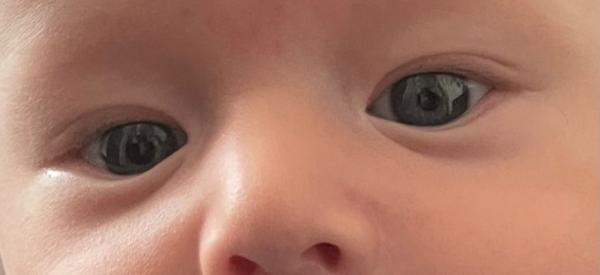 Bild zu Pupillendifferenz - Forum für April - Mamis