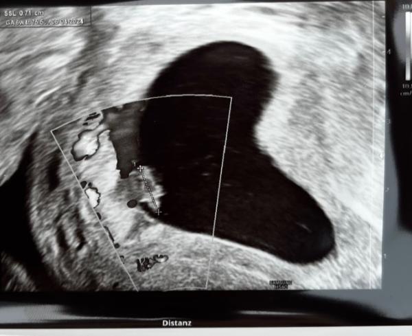 Bild zu 1. FA Termin - Forum für April - Mamis