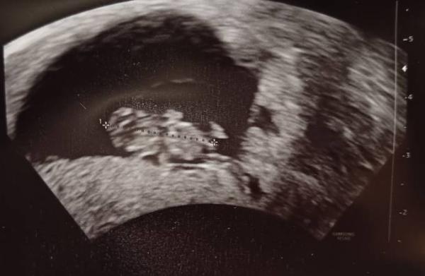 Bild zu Herzschlag - Forum für April - Mamis