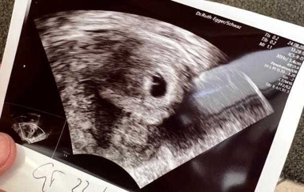 Bild zu Erster Termin - Forum für April - Mamis