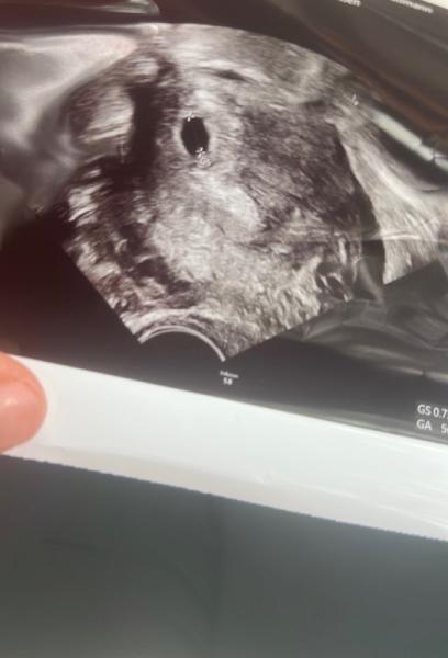 Bild zu Wie kann man positiv bleiben ? - Forum für April - Mamis