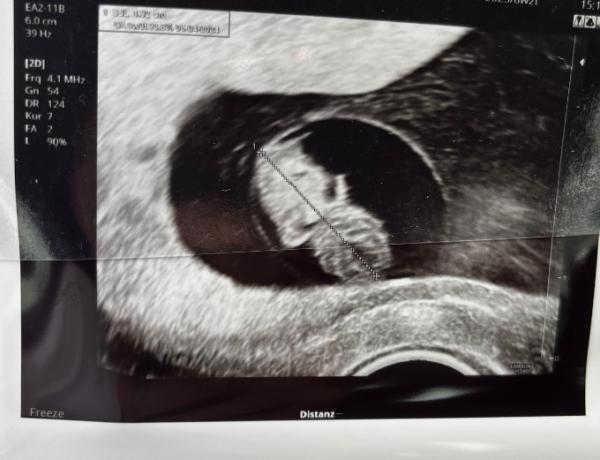 Bild zu Zurück vom Ultraschall - Forum für April - Mamis