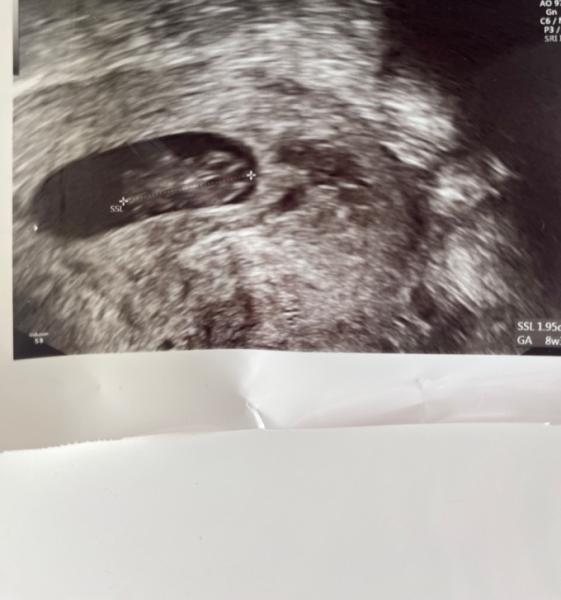 Bild zu Heute Ultraschall - Forum für April - Mamis