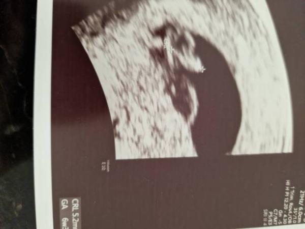Bild zu Erster US bei 6+4 🥰 - Forum für April - Mamis