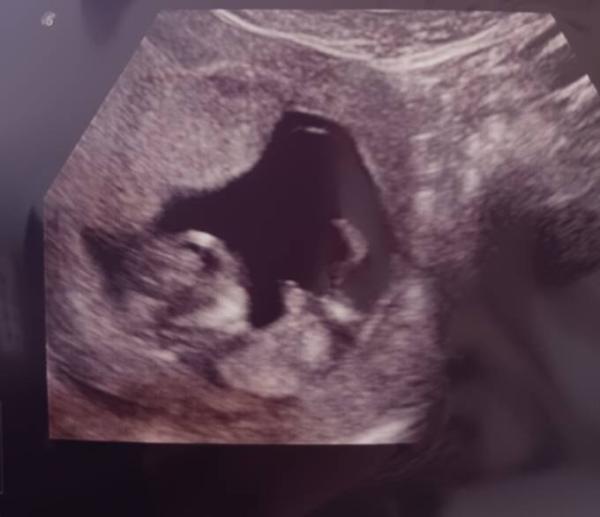 Bild zu Kleine Überraschung - Forum für April - Mamis