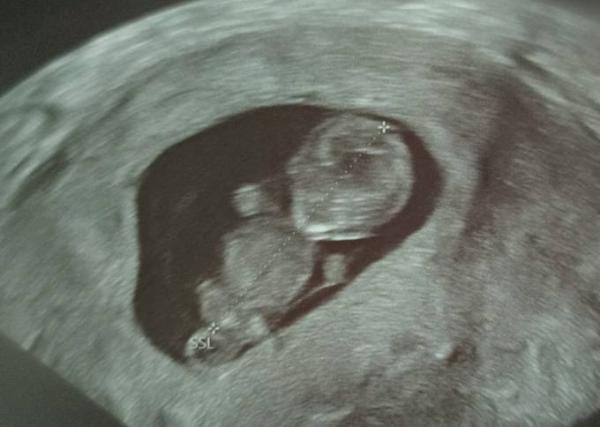 Bild zu Herzchen klopft und Baby bewegt sich fleißig 💕 - Forum für April - Mamis