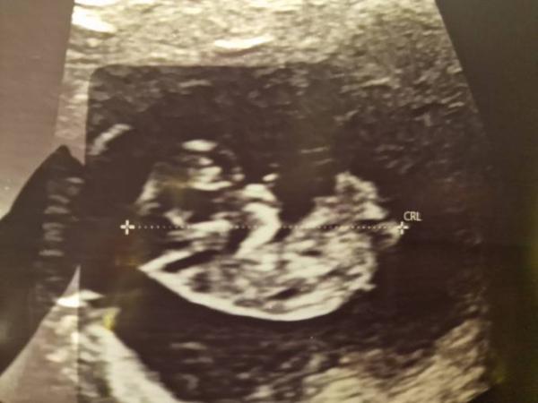 Bild zu 10SSW und alles ist gut 🙂 - Forum für April - Mamis