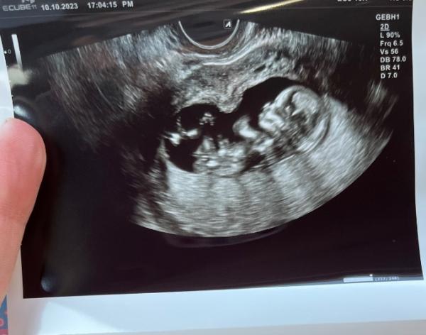 Bild zu Ultraschall - verliebt 🥰 - Forum für April - Mamis
