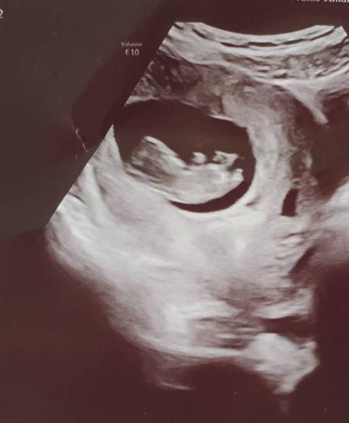 Bild zu Geschlecht jetzt schon erkennbar? - Forum für April - Mamis